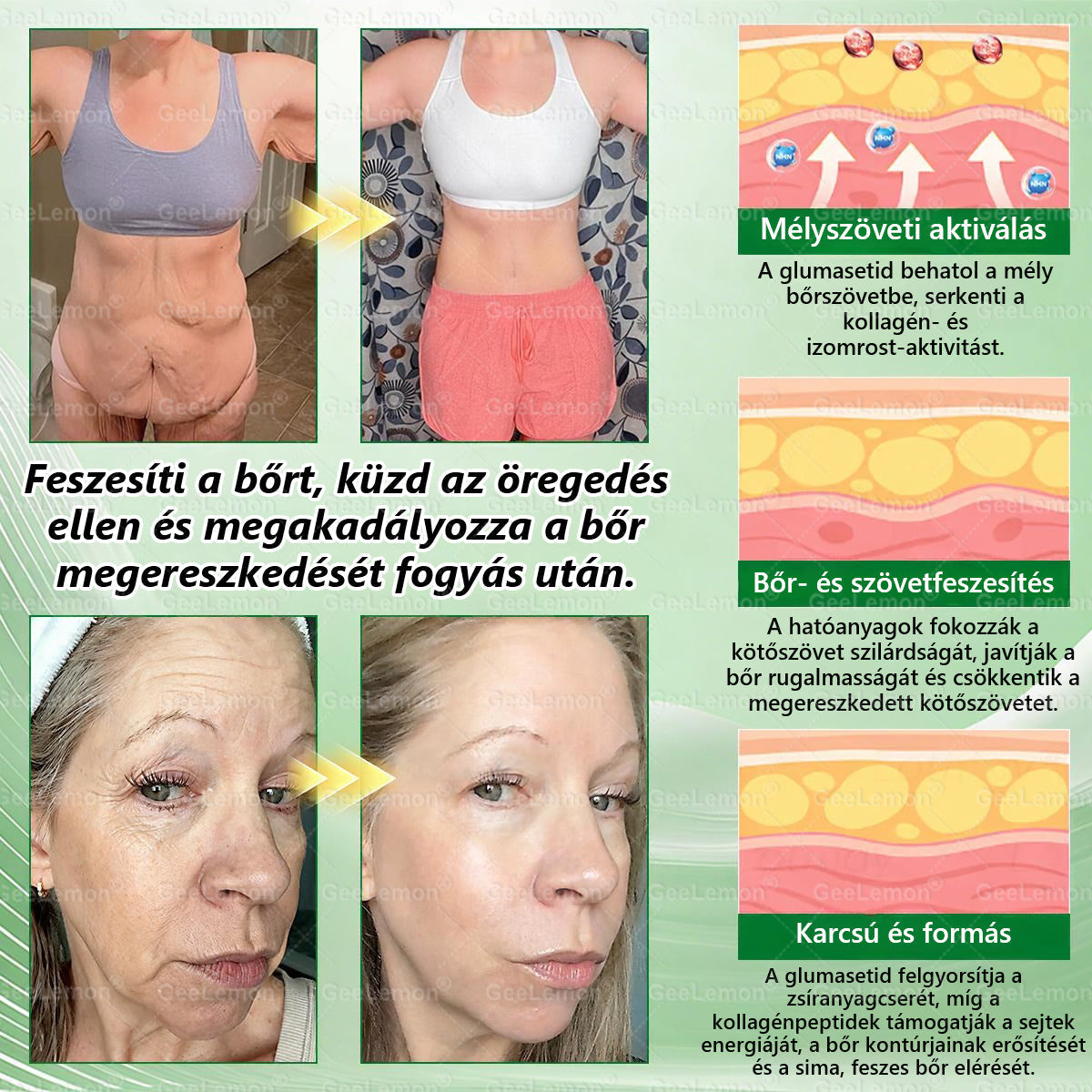 ✅✅Magyar hivatalos bolt🍃 𝐆𝐞𝐞𝐋𝐞𝐦𝐨𝐧® 8 az 1-ben karcsúsító nano mikrotűs tapasz 🇭🇺 Napi egyszeri használat ✅ 7 napon belül látható eredmény – Alkalmas elhízás, szív- és érrendszeri problémák, cukorbetegség és ízületi problémák kezelésére
