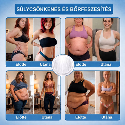 🔥🔥FFBSI® 𝐀𝗠𝗣𝑲𝐌𝗼𝗿𝗶𝗻𝗴𝗮𝐁𝗲𝗿𝗯𝗲𝗿𝗶𝗻𝗲 𝟏𝟎-𝗶𝗻-𝟏 𝐌𝗲𝘁𝗮𝗯𝗼𝗹𝗶𝗸𝘂𝘀 𝐓𝗮́𝗺𝗼𝗴𝗮𝘁𝗮́𝘀 – 𝟏𝟎 𝗳𝗲́𝗹𝗲 𝗵𝗮𝘁𝗼́𝗮𝗻𝘆𝗮𝗴 𝗮 𝗺𝗲𝘁𝗮𝗯𝗼𝗹𝗶𝘇𝗺𝘂𝘀, 𝗲𝗻𝗲𝗿𝗴𝗶𝗮, 𝗮𝗹𝘃𝗮́𝘀, 𝗶́𝘇𝘂̈𝗹𝗲𝘁𝗲𝗸 𝗲́𝘀 𝗮𝗹𝘁𝗮𝗹𝗮́𝗻𝗼𝘀 𝗸𝗼̈𝘇𝗲́𝗿𝘇𝗲𝘁 𝘁𝗮́𝗺𝗼𝗴𝗮𝘁𝗮́𝘀𝗮́𝗿𝗮